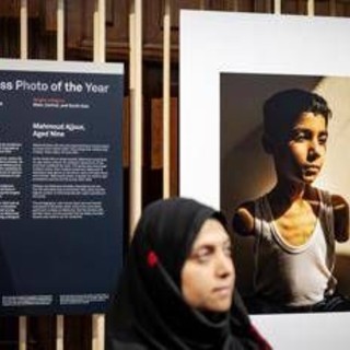 World Press Photo, nella foto dell'anno un bambino mutilato a Gaza