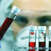 Emofilia, in Italia nuova soluzione sottocute giornaliera per pazienti con inibitori