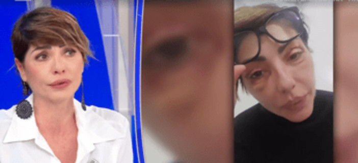 Ilaria Galassi, insulti social per i ritocchi estetici: "Offese anche sui miei figli"