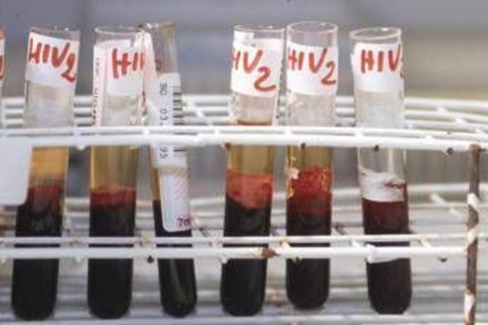 Hiv, il 90% dei pazienti sceglie terapia long acting