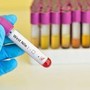 West Nile, Italia al primo posto in Europa per casi nell'uomo: il report Ecdc
