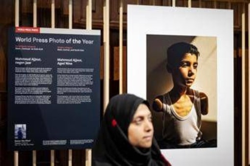 World Press Photo, nella foto dell'anno un bambino mutilato a Gaza