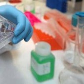 Cancro alla vescica, Berardi (Aiom): "Sangue nelle urine segnale da non sottovalutare" Cancro alla vescica, Berardi (Aiom): "Sangue nelle urine segnale da non sottovalutare"