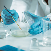 Linfoma mantellare, 'con trattamento chemio-free in prima linea -43% rischio di progressione o morte' Linfoma mantellare, 'con trattamento chemio-free in prima linea -43% rischio di progressione o morte'
