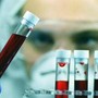 Alzheimer, Sin: &quot;Test del sangue svolta epocale per diagnosi tempestive e cure mirate&quot;