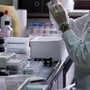 Tumori, biopsia liquida e su tessuti: cura mirata su doppio test migliora sopravvivenza