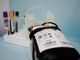 Emergenza sangue in Italia, chi può donarlo e ogni quanto Emergenza sangue in Italia, chi può donarlo e ogni quanto