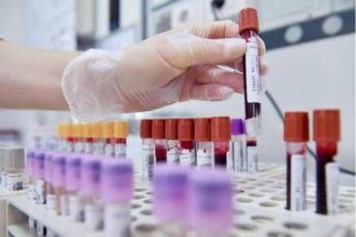 Tumore alla prostata, novità nelle terapie dei casi più gravi