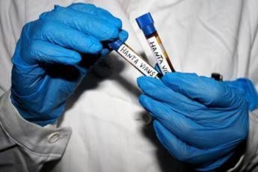Hantavirus, Ema monitora diffusione: "Pronti a supportare iter vaccini" Hantavirus, Ema monitora diffusione: "Pronti a supportare iter vaccini"