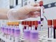Sclerosi multipla recidivante, Ema raccomanda approvazione ocrelizumab dai 10 anni Sclerosi multipla recidivante, Ema raccomanda approvazione ocrelizumab dai 10 anni
