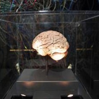 Medicina, neurologi: &quot;L'innovazione può cambiare la storia di molte malattie ma serve equità&quot;