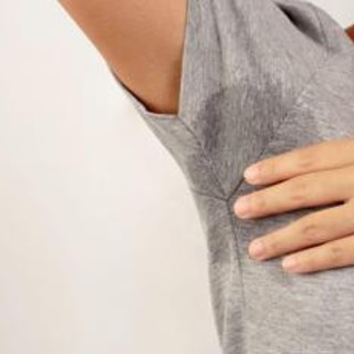 Svelato l'interruttore genetico che fa sudare troppo, nuove speranze per l'iperidrosi