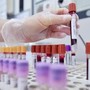 Cancro al seno, oncologi: &quot;Bene test genomici nei nuovi Lea, fare presto&quot;