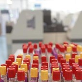 Malaria in aeroporto in Germania, gli esperti: "Campanello d'allarme, ma il rischio resta contenuto"