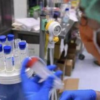 Focolaio di legionella a Milano, una casa positiva: ora si controlla l'acquedotto