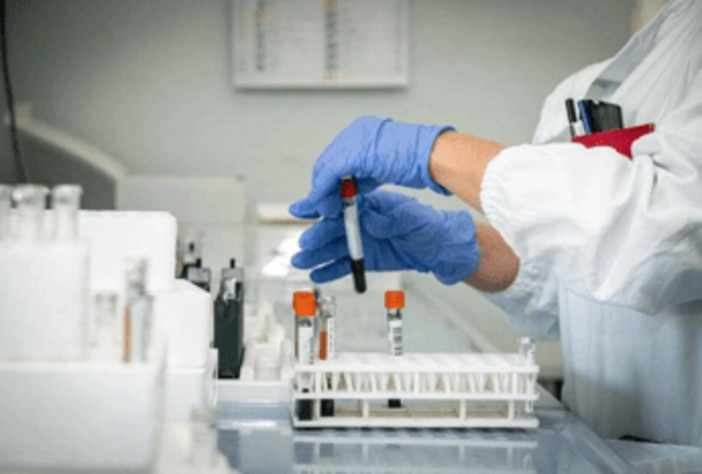 Hantavirus, 4 persone monitorate in Italia: "Non hanno sintomi" Hantavirus, 4 persone monitorate in Italia: "Non hanno sintomi"