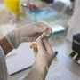 Cancro prostata metastatico ormonosensibile, nuovi dati su darolutamide mostrano benefici in sopravvivenza Cancro prostata metastatico ormonosensibile, nuovi dati su darolutamide mostrano benefici in sopravvivenza