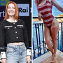 Dalla chioma alle gambe, Noemi ironizza sulla scottatura: &quot;Mai senza crema&quot;