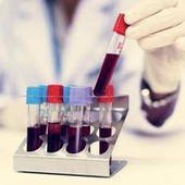 Come vivere più a lungo? Il test del sangue svela la longevità Come vivere più a lungo? Il test del sangue svela la longevità