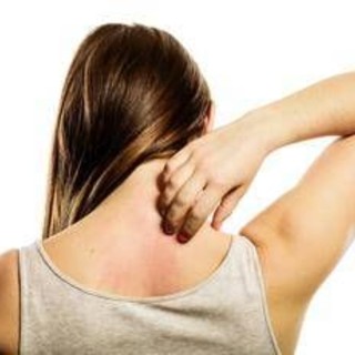 Linfoma cutaneo a cellule T, esperta: "Diagnosi difficile per sintomi dermatologici"