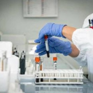 Alzheimer, nuovo test del sangue potrebbe prevedere sintomi imminenti Alzheimer, nuovo test del sangue potrebbe prevedere sintomi imminenti