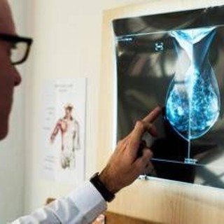 Cancro al seno, crioablazione nuova frontiera di cura