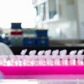 Staminali contro il Parkinson, in Giappone via libera al primo trattamento