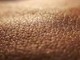 Dermatite atopica, quando la pelle condiziona la vita, 'Diari atipici' dà voce ai pazienti