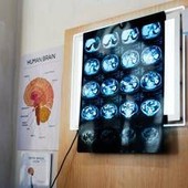 "11 anni di chemio per un tumore che non c'era", la diagnosi sbagliata e l'incubo "11 anni di chemio per un tumore che non c'era", la diagnosi sbagliata e l'incubo