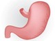 Caldo peggiora sintomi del reflusso, in casi gravi &quot;chirurgia opzione risolutiva&quot;
