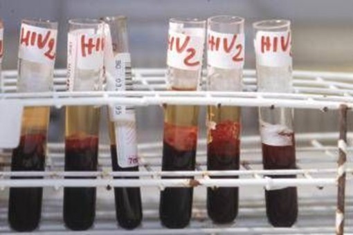 Aids, l'accusa di Bassetti: &quot;Torna a far paura per colpa di Trump&quot;