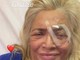 Mara Venier in ospedale e l'intervento all'occhio: "Chiudo l'anno così" Mara Venier in ospedale e l'intervento all'occhio: "Chiudo l'anno così"
