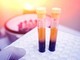 Farmaci, Sava (Sif Magazine): &quot;In plasmaderivati attenzione particolare a sicurezza&quot;